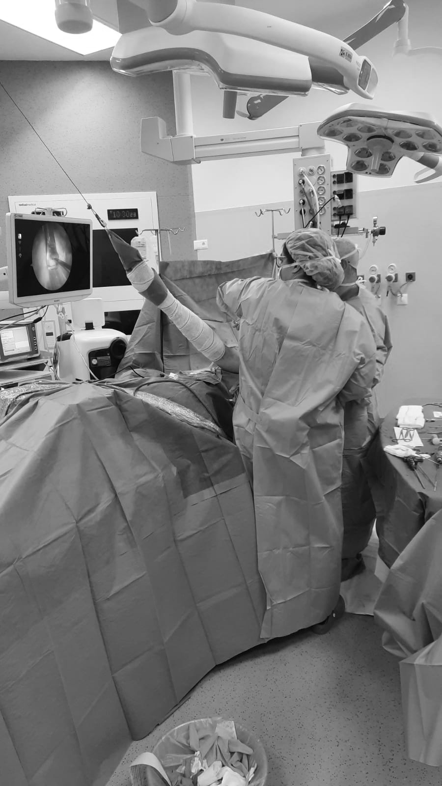 fractura de escapula